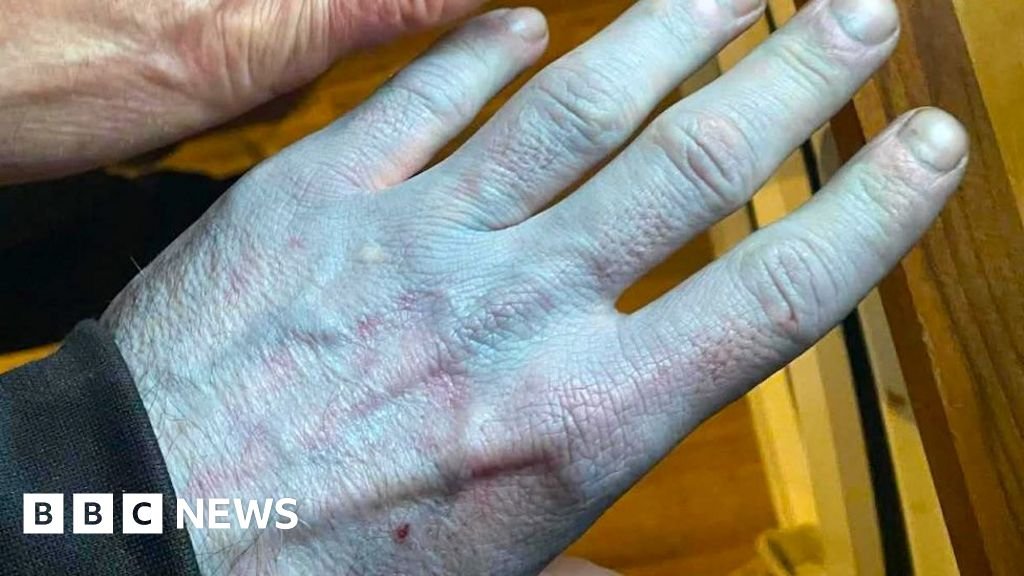 Weekly quiz: How did this man accidentally turn himself blue?