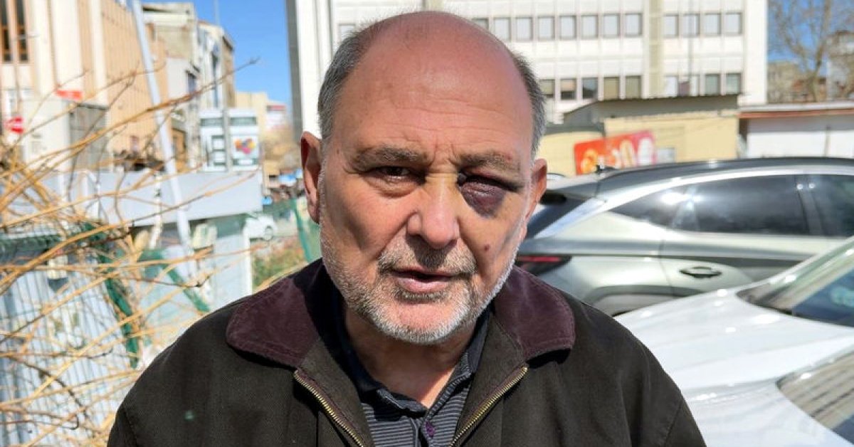 Çift görüyorum, iyi değilim, şikayetçiyim