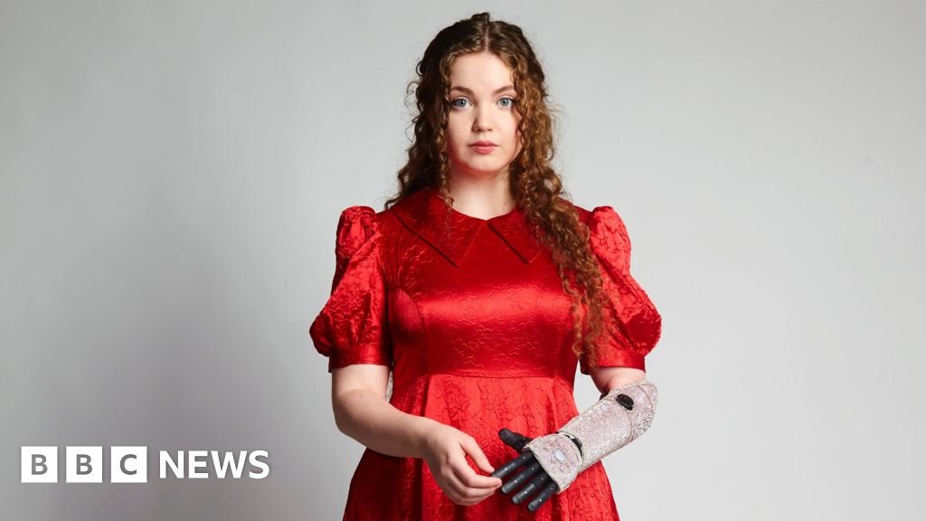 Bridgerton actor told disability could hold her back – then Netflix came calling